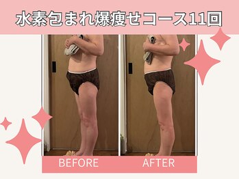 ヨサパーク ビーチ 花畑店(YOSA PARK BEACH)/水素包まれ爆痩せコースの結果☆