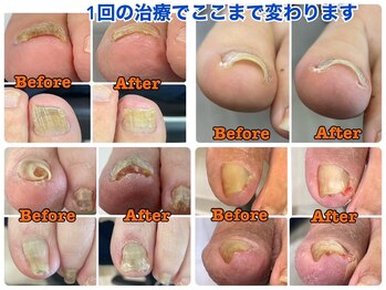 小田急相模原巻き爪矯正センター
