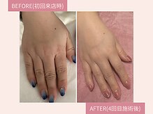 イユー(IU)/透明感仕上がり比較