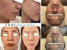 サロン アイプラス(salon i plus)