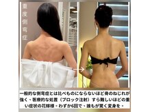 ソウ バイ ソウ(So by 蒼)の雰囲気(一般的な整体や機器では解決できない側湾の方へ。『駆け込み寺』)