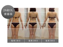 美癒 池袋本店/【ビフォア⇒アフター】（2）