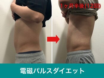 ミスターアンクール 鹿児島(Mr.uncoeur)/自動筋トレ12回後