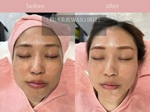 ジョリー(JOLi)/顔脱毛/韓国美肌ワックス