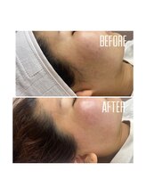 ホワイトワックス 京都四条烏丸(WHITE WAX)/横顔スッキリ！！