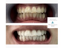 プラチナムビューティー 横須賀店/ビフォーアフター