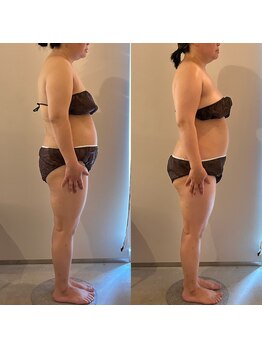 ラナ 京都西院店(Lana)/姿勢が変わると体のラインも変化