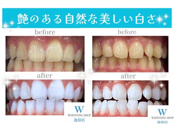 ホワイトニングショップ 池袋店