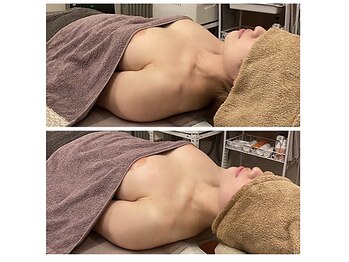 ベンザイ 梅田店(BENZAI)/下垂、巻肩、猫背、離れ