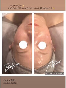 美緑/【別人級!?】最強エステ