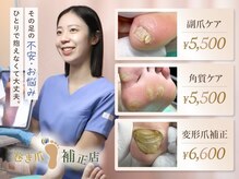 巻き爪補正店 溝の口店の雰囲気（巻き爪補正店メニュー。巻き爪/肥厚爪/角質/タコ/魚の目）