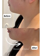 マウム(Maum)/二重あごすっきり・Vライン