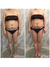 ラニ(LANI)/新型ハイパーナイフ6