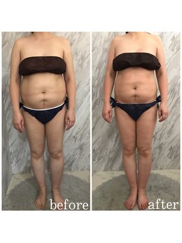 ラニ(LANI)/新型ハイパーナイフ6