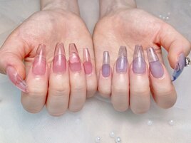 チップスカルプ