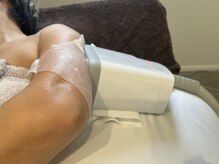 サンビューティー(San beauty)/脂肪冷却