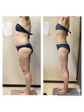 ビボディラボ 海老名店(美Body Labo)/体重　75.0kg→56.4kg(18.6kg)