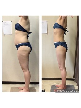 ビボディラボ 海老名店(美Body Labo)/体重　75.0kg→56.4kg(18.6kg)