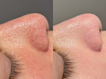 ルーナジェーナ(Luna llena)/池袋　エステ　ルーナジェーナ