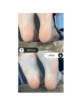 イチロクイチハチ(1618)/夏前にケアを