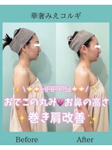 アコガレコガオ 鳥取店/コルギのビフォーアフター