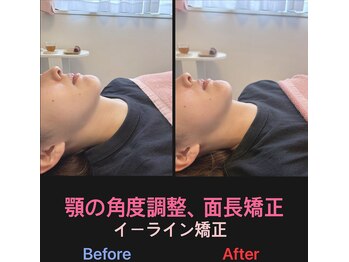 美容矯正サロン レレポノ(LELEPONO)/