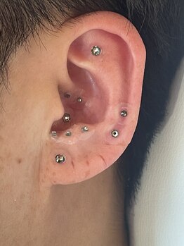 ラピス(Lapis)/耳つぼジュエリー施術例☆