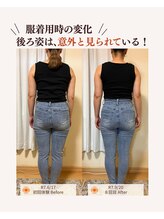 ユナリ(yunari)/40代前半｜Before・After…２