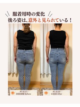ユナリ(yunari)/40代前半｜Before・After…２