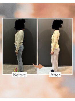 東船橋スタンス整体院の写真/猫背・巻き型・ストレートネックは揉まない整える！胸を張るのはもう終わり！姿勢矯正で美姿勢を目指して♪