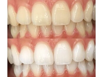 プロテア 藤枝店(PROTEA)/医療提携サロン.ホワイトニング