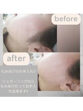 シュガーリングハウスレディ(SugaringHouse LADY)/もみあげ綺麗！