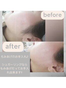 シュガーリングハウスレディ(SugaringHouse LADY)/もみあげ綺麗！