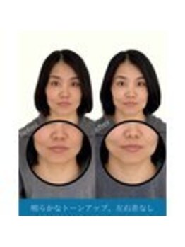 ハリラボ 仙台上杉店(hari Lab.)/【お客様の声】