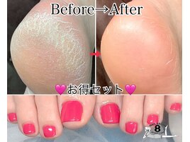 サンダル映え踵ケア&Fワンカラー