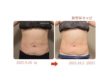 サロン ド 花歩 松山本店/新型Wキャビ２回の結果