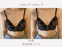 ハリスタ 西宮院(HARISTA)/3ヶ月間でAカップ→Dカップ