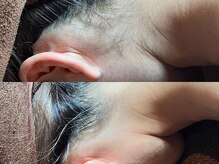 ゴールデンエイジ 吉祥寺(GOLDEN AGE)/ワックス脱毛：施術