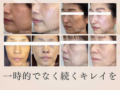 ブルースターの写真