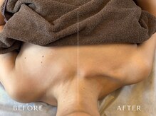 ココモドルの雰囲気（神経アプローチをする事で、即効性と持続性があります。）