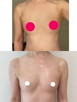 ワイサロン(Y salon)/50代/産後バスト/C→Dカップ