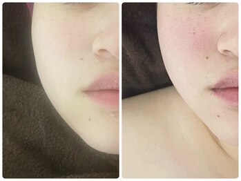 ナナマルニ 高知店(702)/フェイスライン★