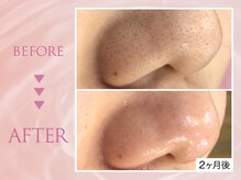 クリアラボ 川崎(Clear Lab)/韓国式肌管理&毛穴洗浄専門店