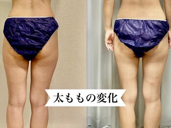 アンジュ(Ange)/長年の悩み悩み！解決！