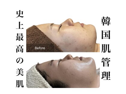 リノア(Lino'aka)の写真