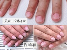 フレンチホリック(French Holic)の雰囲気（爪噛み、爪いじり、深爪のお悩み解消できます。お子様も可。）