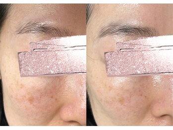 モガナ(mogana)/半年パスポート/サブスクプラン