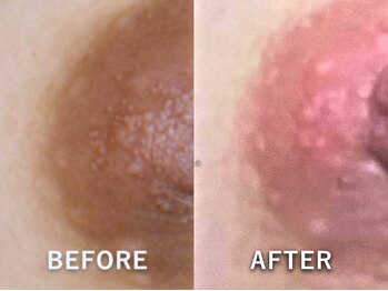 ドアディ(Doordie)/ローマピンク