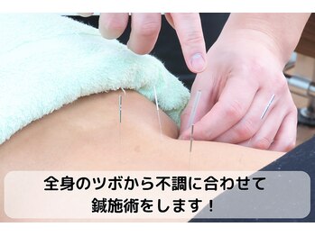あさひろ鍼灸整骨院 新宿院/【鍼施術】全身のツボを選穴