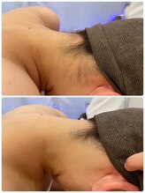 スリーズララ 大船駅前店(Cerise LaLa)/◆うなじ美人への第一歩◆